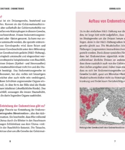 Alternative view of Buch | In der Sprechstunde: Endometriose – Erkennen • Verstehen • Behandeln